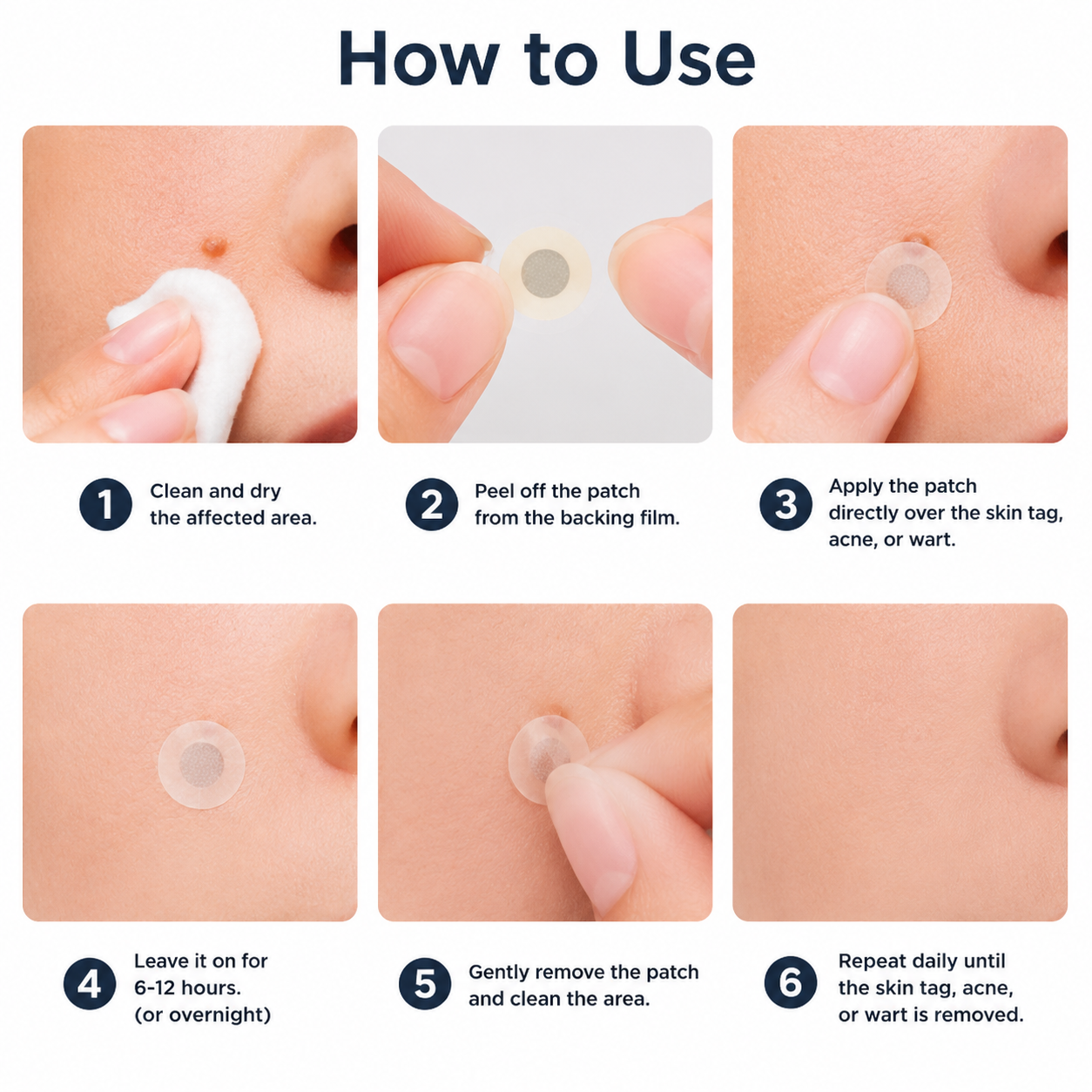 toccera® Microneedle Clear Patches ✨Targets Skin Tags, Acne, Wrinkles & Blemishes