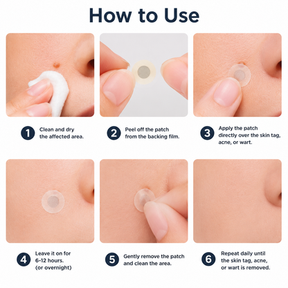 toccera® Microneedle Clear Patches ✨Targets Skin Tags, Acne, Wrinkles & Blemishes