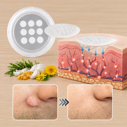 toccera® Microneedle Clear Patches ✨Targets Skin Tags, Acne, Wrinkles & Blemishes