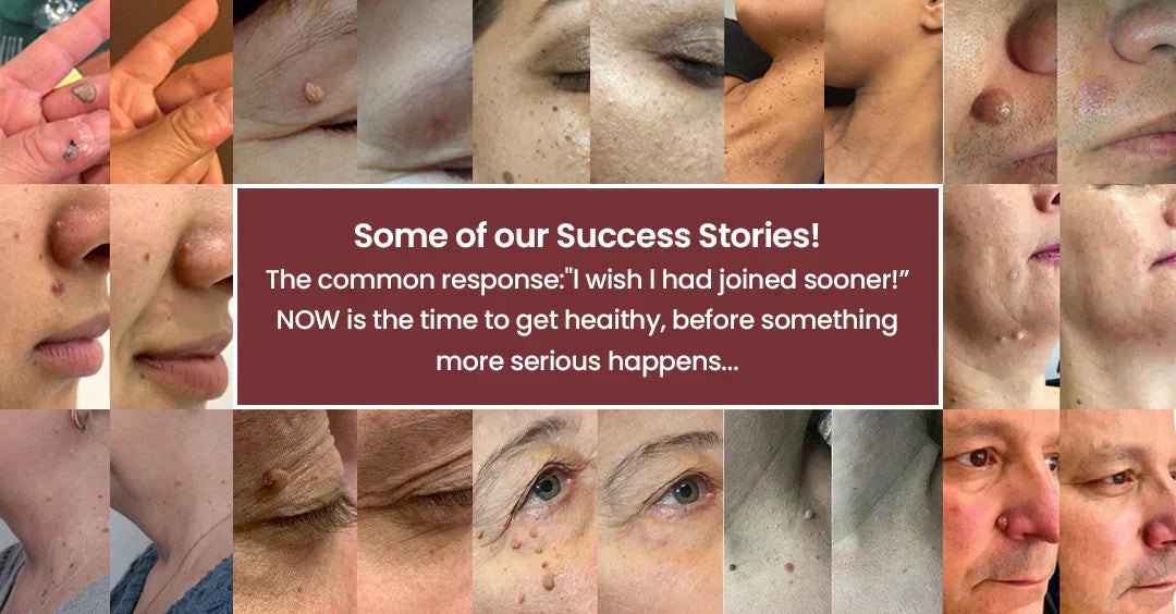 toccera® Microneedle Clear Patches ✨Targets Skin Tags, Acne, Wrinkles & Blemishes